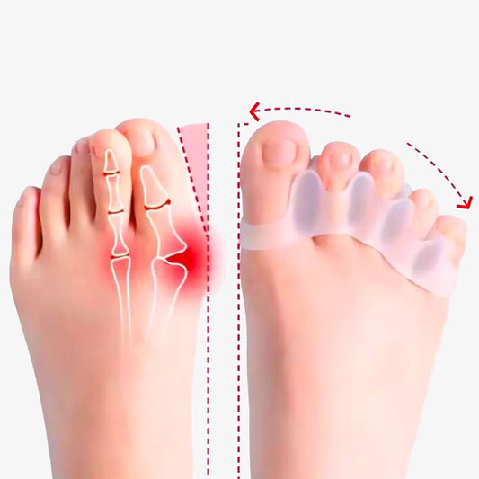 Feral Walk™ Silicone Toe Separator